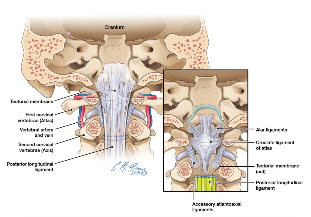Alar ligaments in children and craniocervical junction anatomy